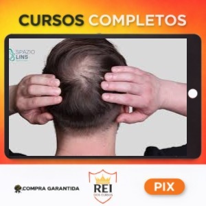 Projeto Revertendo a Calvície - Petronio Santos